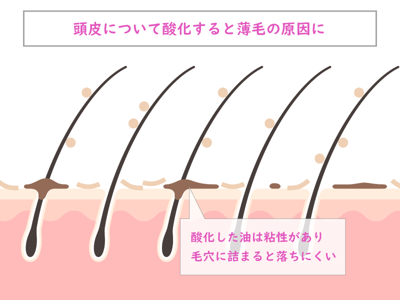 ヘアオイルが頭皮につくと薄毛の原因